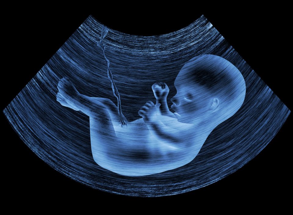 Restrição de crescimento intrauterino